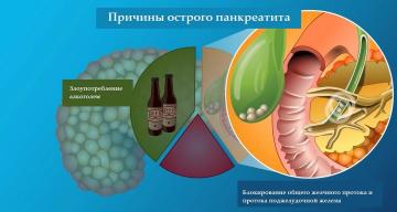 Treat doğal ilaçlar pankreatit: Hızla ağrı ve iltihap ortadan kaldırmak